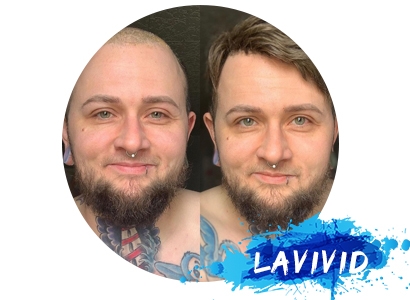 A Detailed Demonstration of LaVivid Ares Men's Hair System