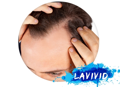 The Way to Solve The Hair Fall for  Men