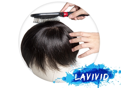 Hair Loss Issue Appears in the Young Men